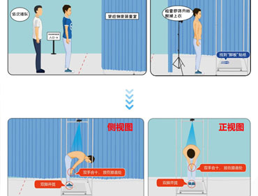 智能脊柱侧弯筛查系统