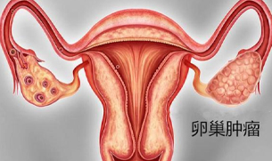 宫颈炎患者该做的护理事项有什么