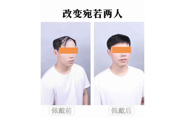 假发对比图
