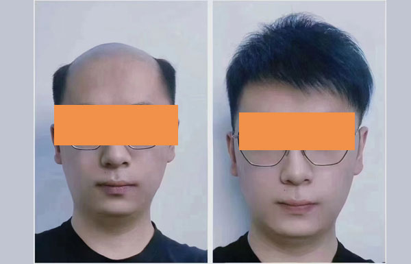 假发对比图