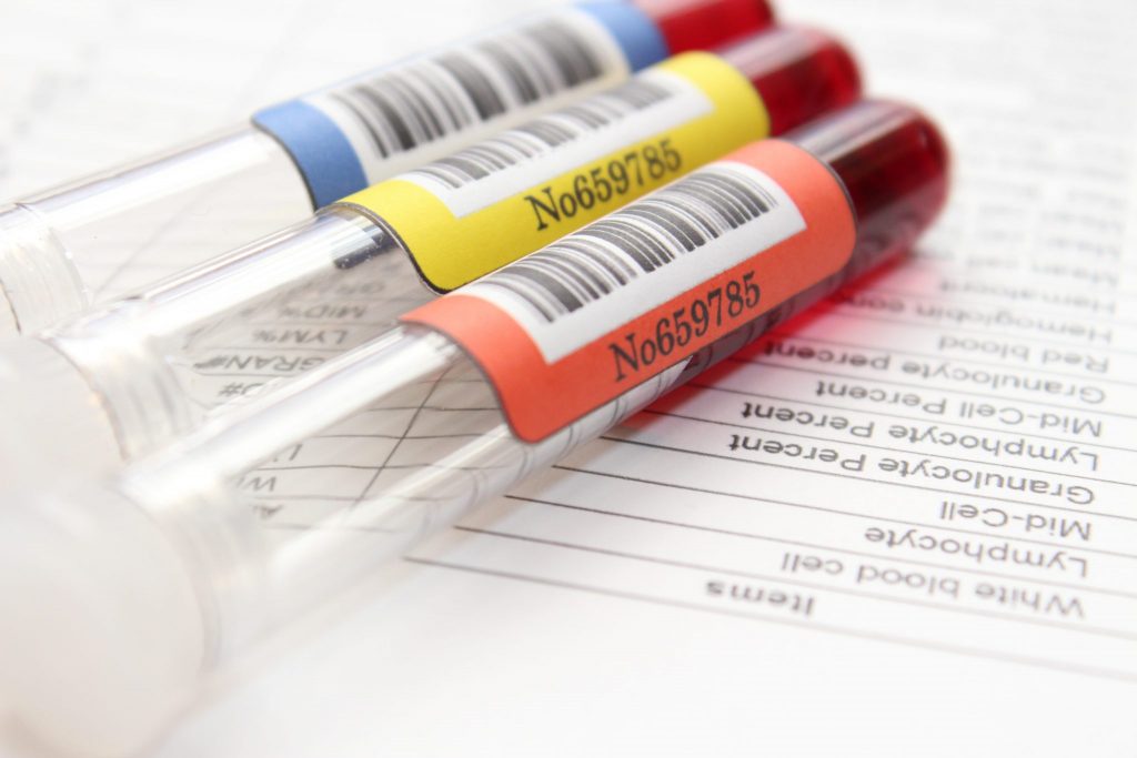 全美血液肿瘤治疗的先驱:患者与骨髓捐赠者的感人重逢