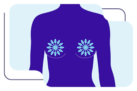 安德森癌症中心:成功治 愈乳房软组织肉瘤的奇迹故事