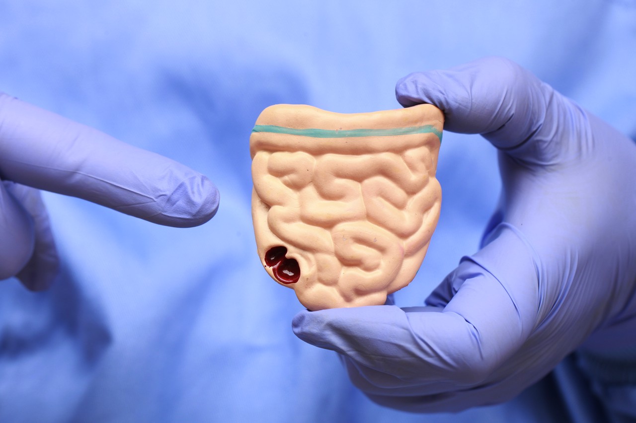 结直肠癌治疗演进:经典与创新药物盘点