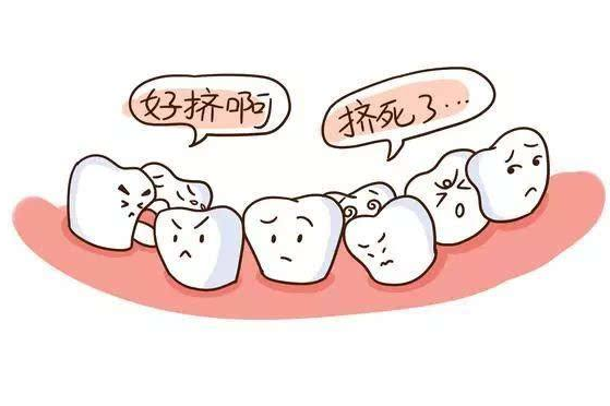 牙列不齐乳恒牙交替时期通常也被称为丑牙期,牙齿的排列常常不是