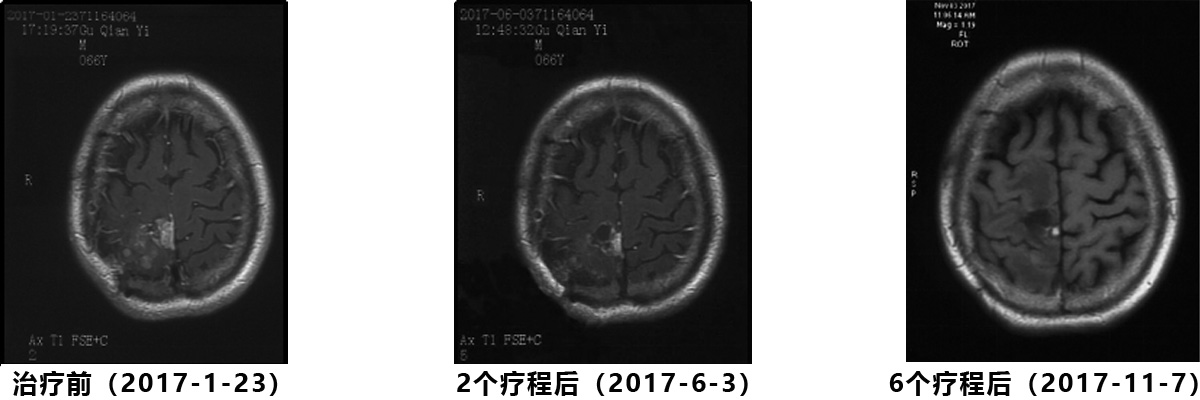 84083