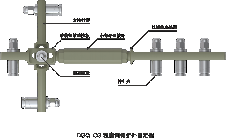 粗隆间骨折外固定器